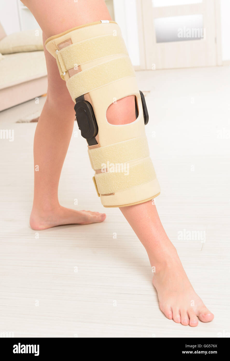 Woman's leg in knee cages for stabilization and support Stock Photo Alamy