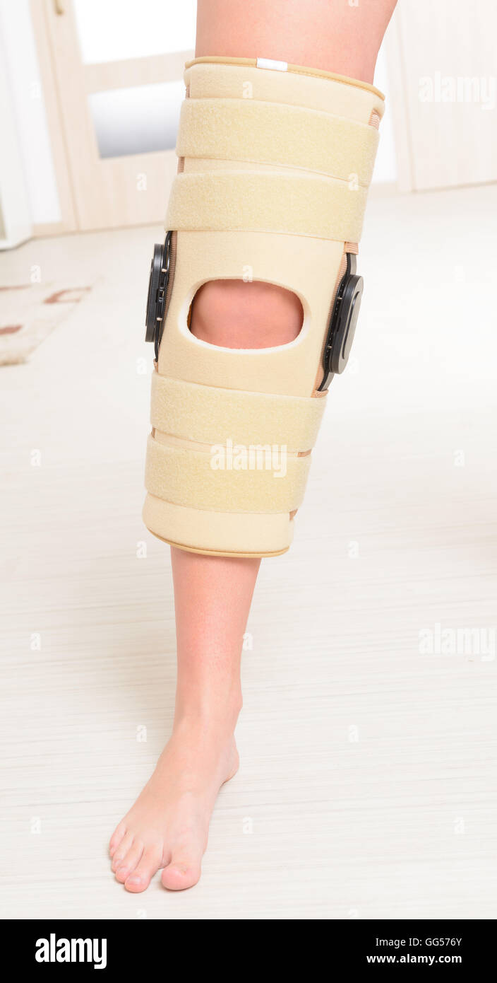 Woman's leg in knee cages for stabilization and support Stock Photo