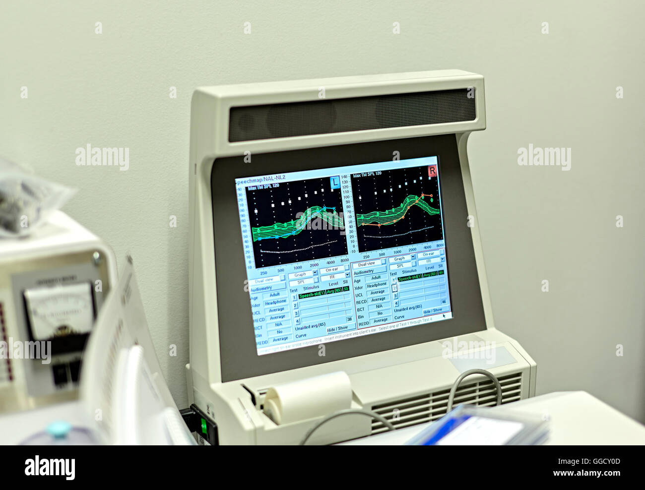 Monitor showing a speech map during a hearing test Stock Photo Alamy