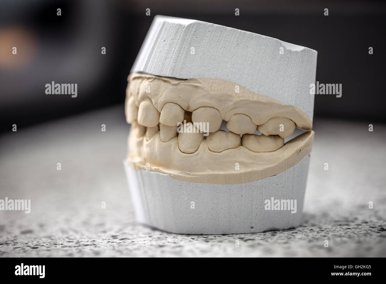 Mold of teeth. Gypsum model plaster of teeth. Stomatologic plaster cast,  molds of human jaws and teeth on gray background. Dentistry and  orthodontics concept Stock Photo