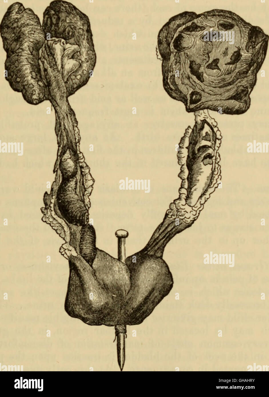 An American text-book of the diseases of children (1895 Stock Photo - Alamy