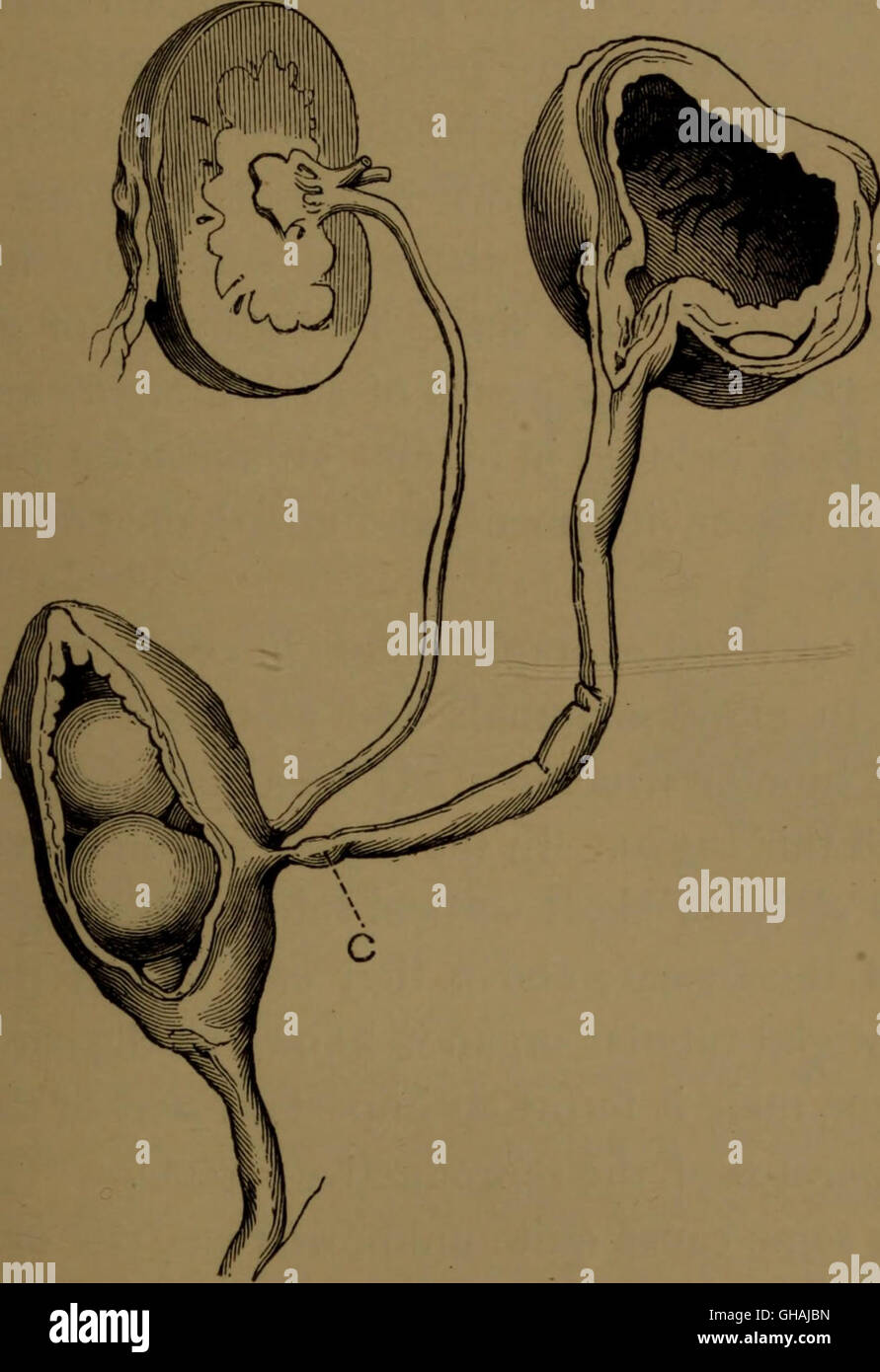 Evolution And Disease 1890 Stock Photo Alamy Evolution And Disease 1890 Stock Photo Alamy