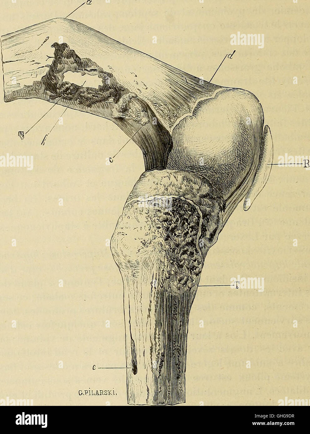 Traité de chirurgie clinique et opératoire (1896) Stock Photo