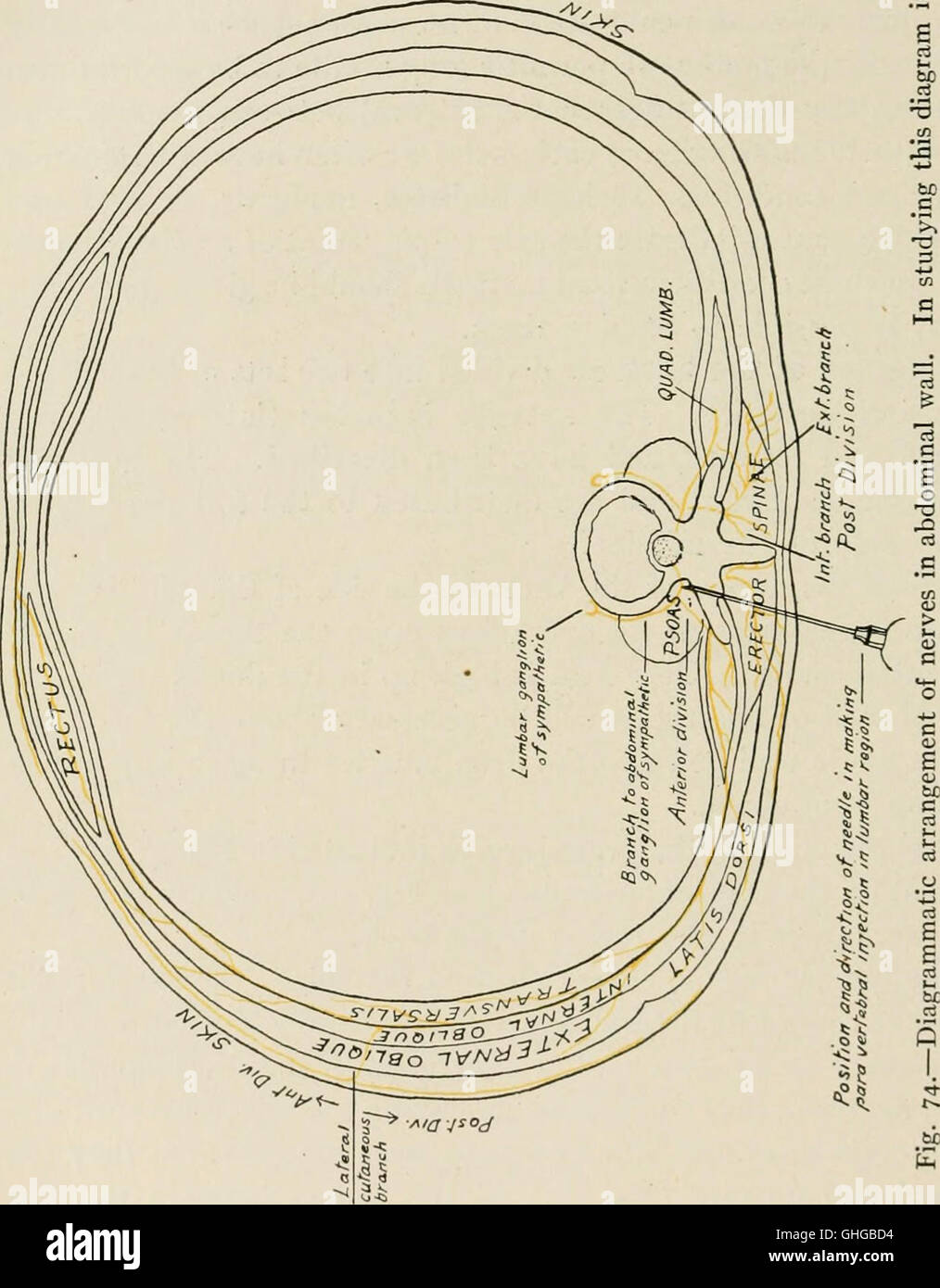 Local and regional anesthesia; with chapters on spinal, epidural
