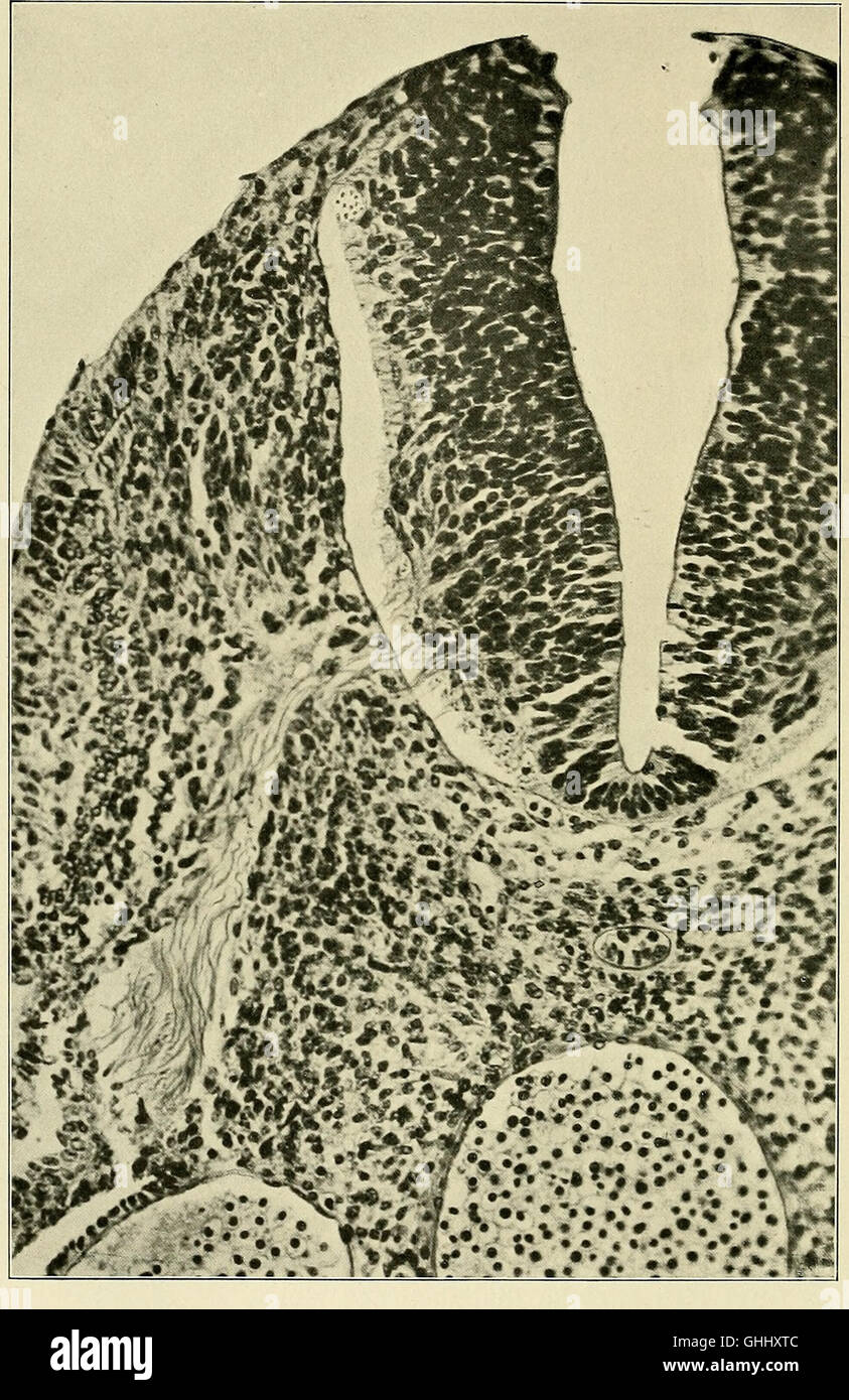 This 1904 German study focuses on the development of the human brain ...