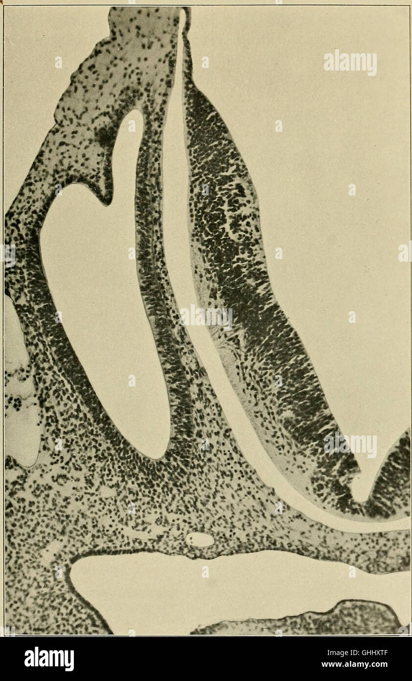 A 1904 German study titled 'The Development of the Human Brain during ...