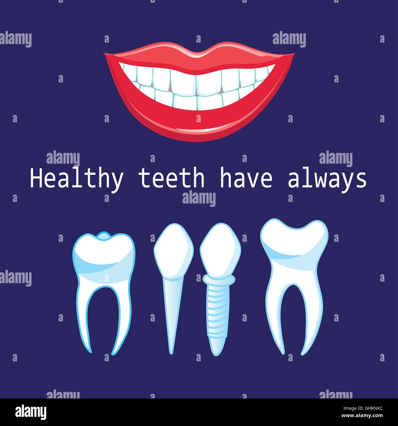 Vector healthy teeth and implants Stock Vector Image & Art - Alamy