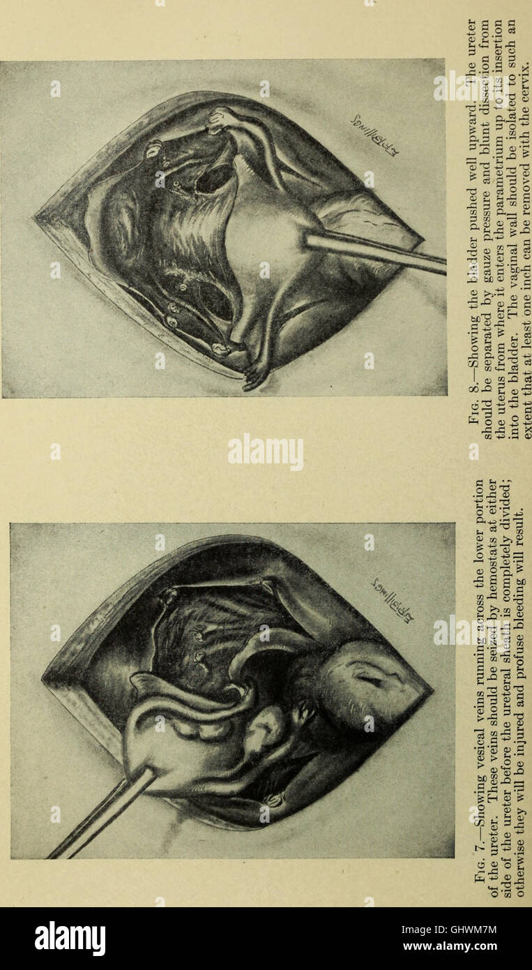 Transaction Surgery The 'Transactions of the Southern Surgical and Gynecological ...