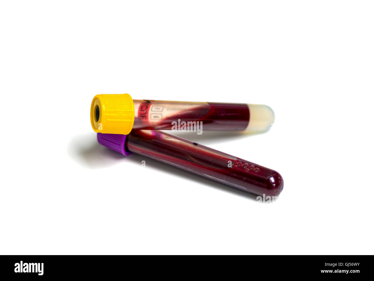 Blood sample on white background Stock Photo Alamy