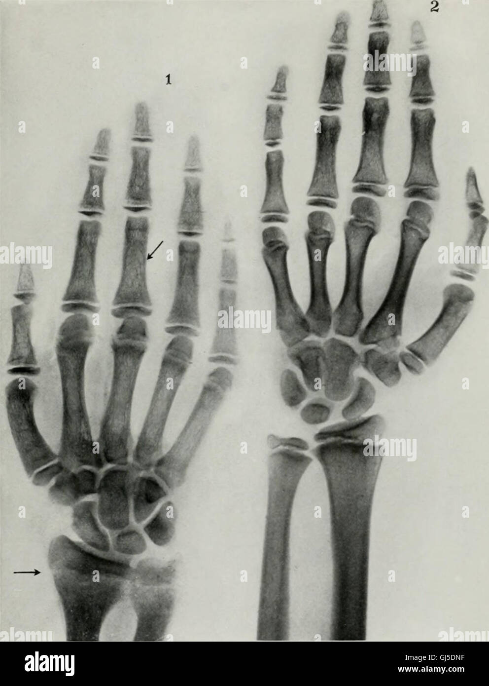 Living anatomy and pathology; the diagnosis of diseases in early life by the Roentgen method (1910) Stock Photo