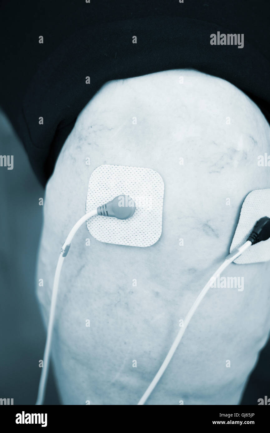 Electrode stimulation electro physiotherapy electrodes in medical