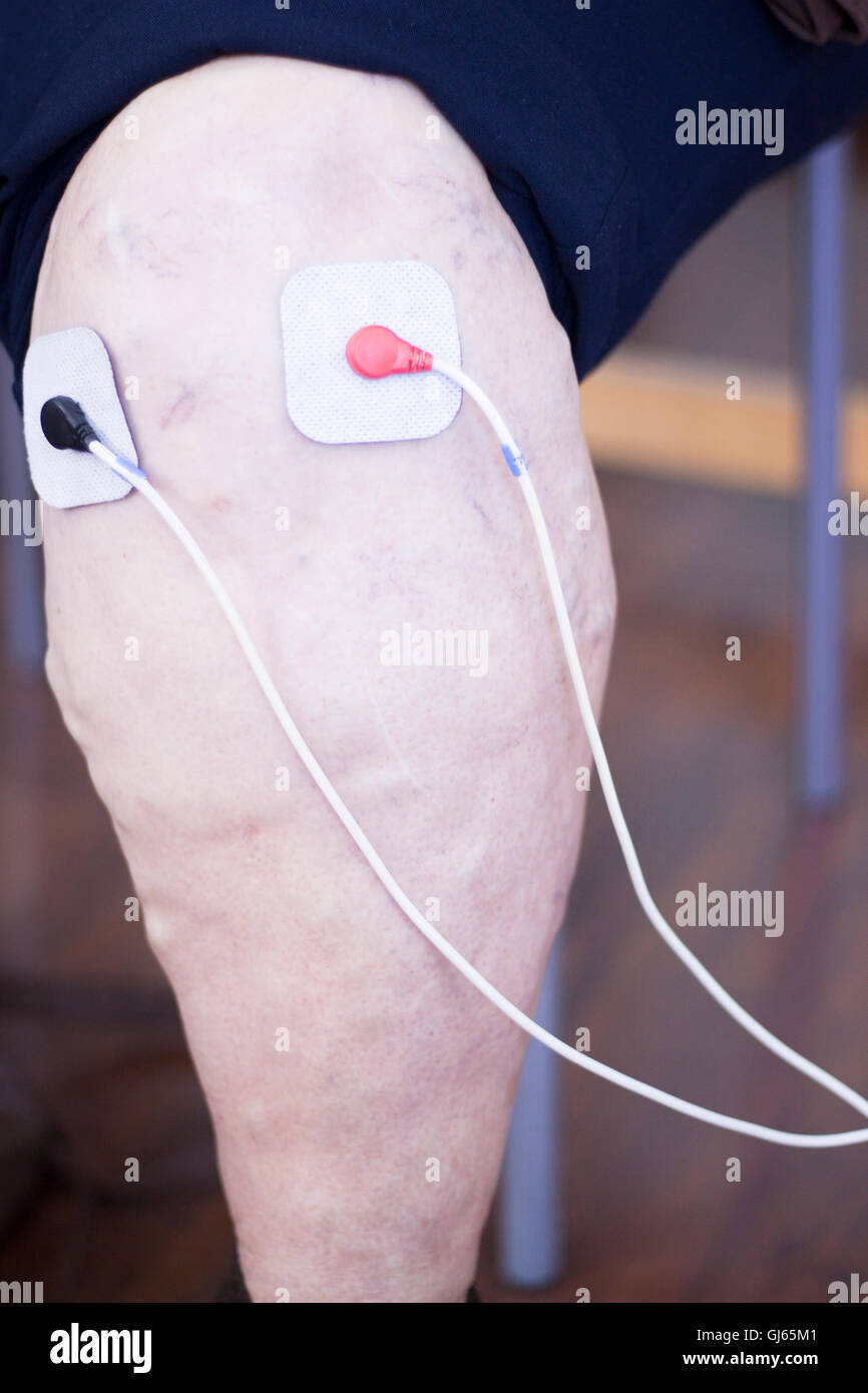 https://c8.alamy.com/comp/GJ65M1/electrode-stimulation-electro-physiotherapy-electrodes-in-medical-GJ65M1.jpg