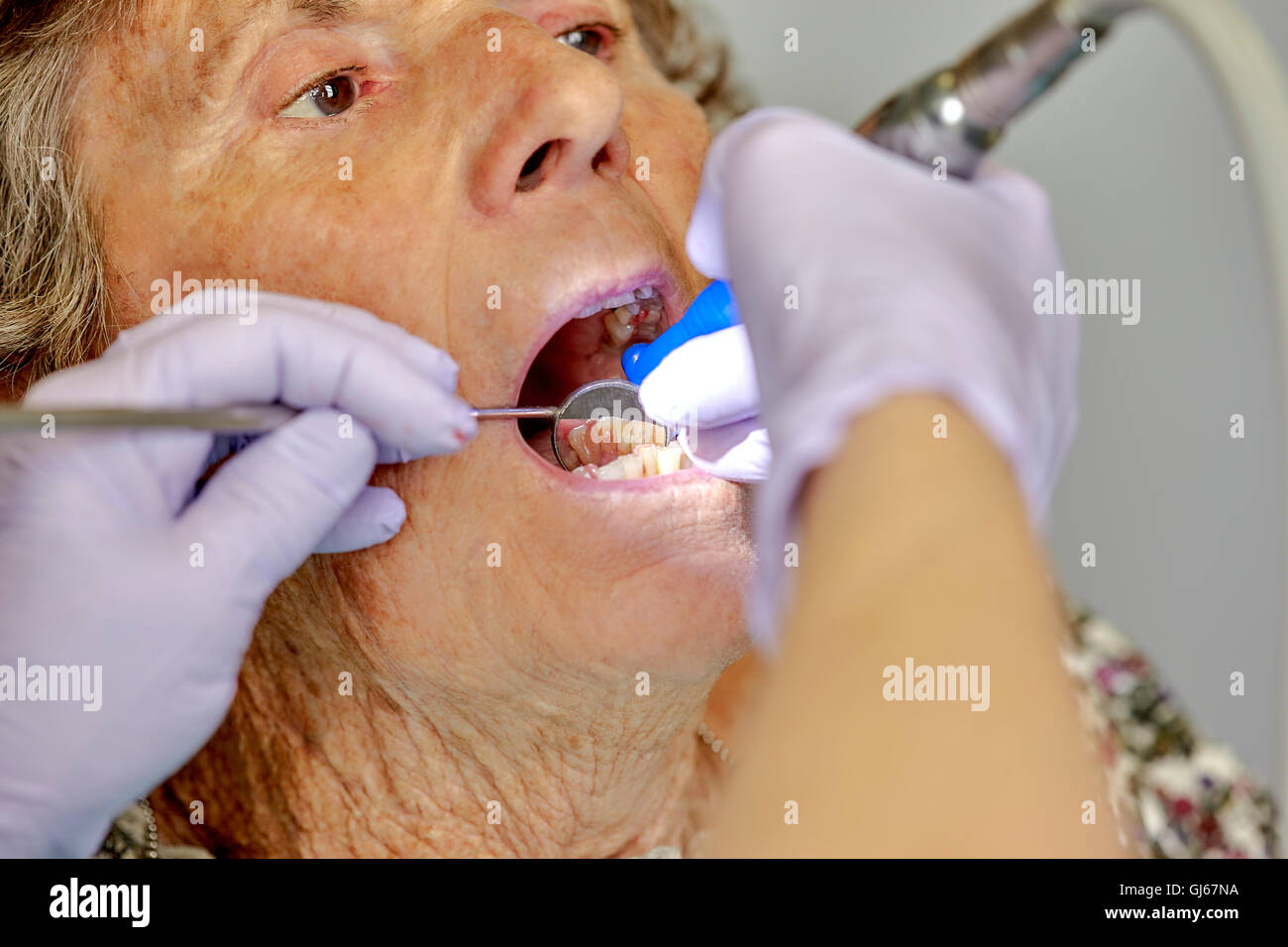 Elderly woman having her teeth cleaned by a dental hygienist Stock Photo