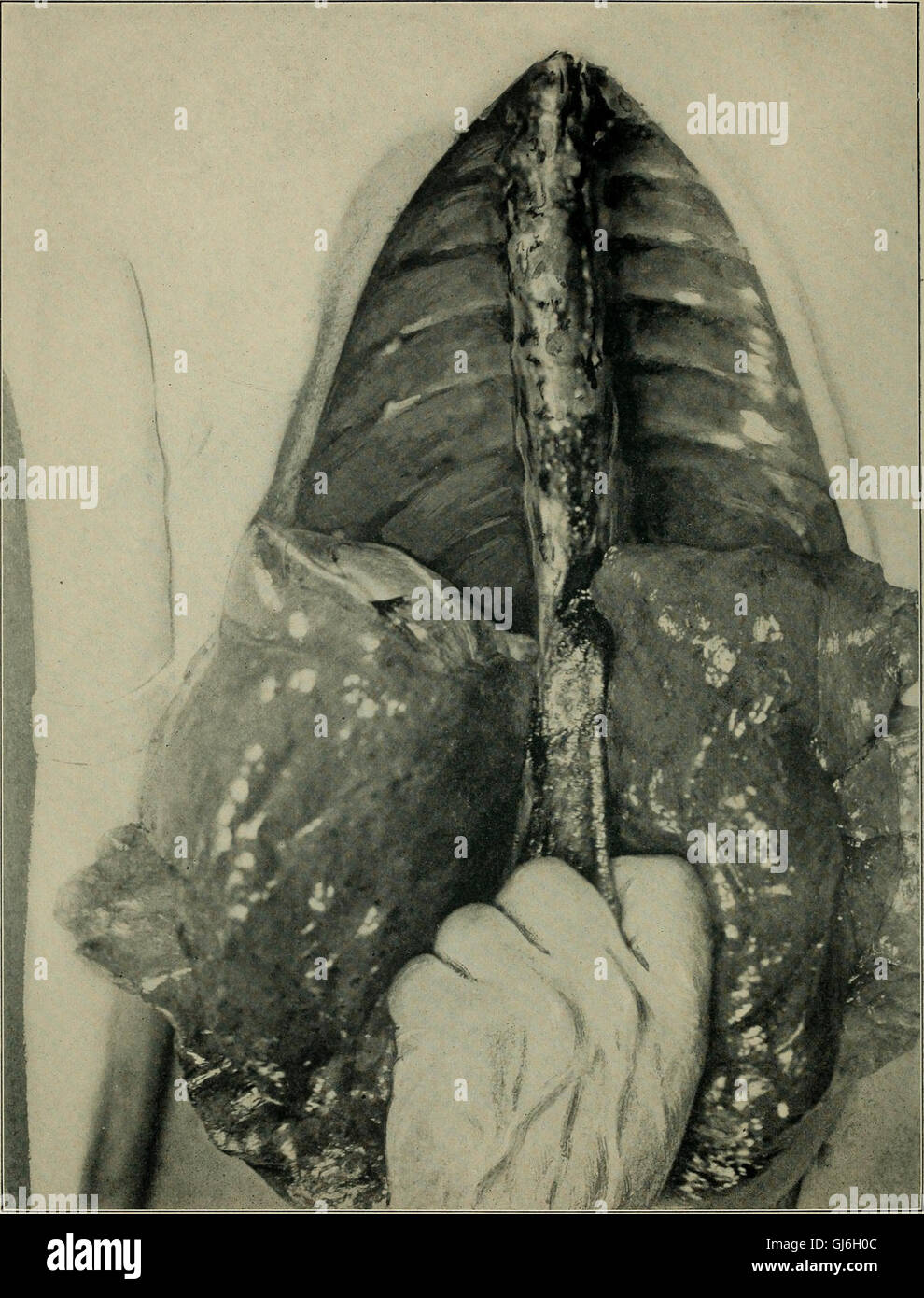 A 1906 manual on postmortem pathology, detailing techniques for conducting post-mortem examinations and interpreting the results. Stock Photo