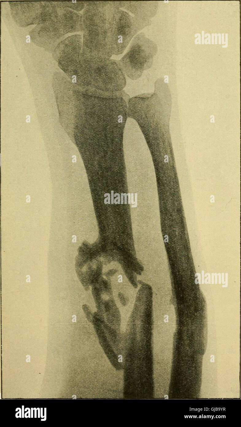 *Wounds in War* (1910) discusses the nature of battle injuries, the ...