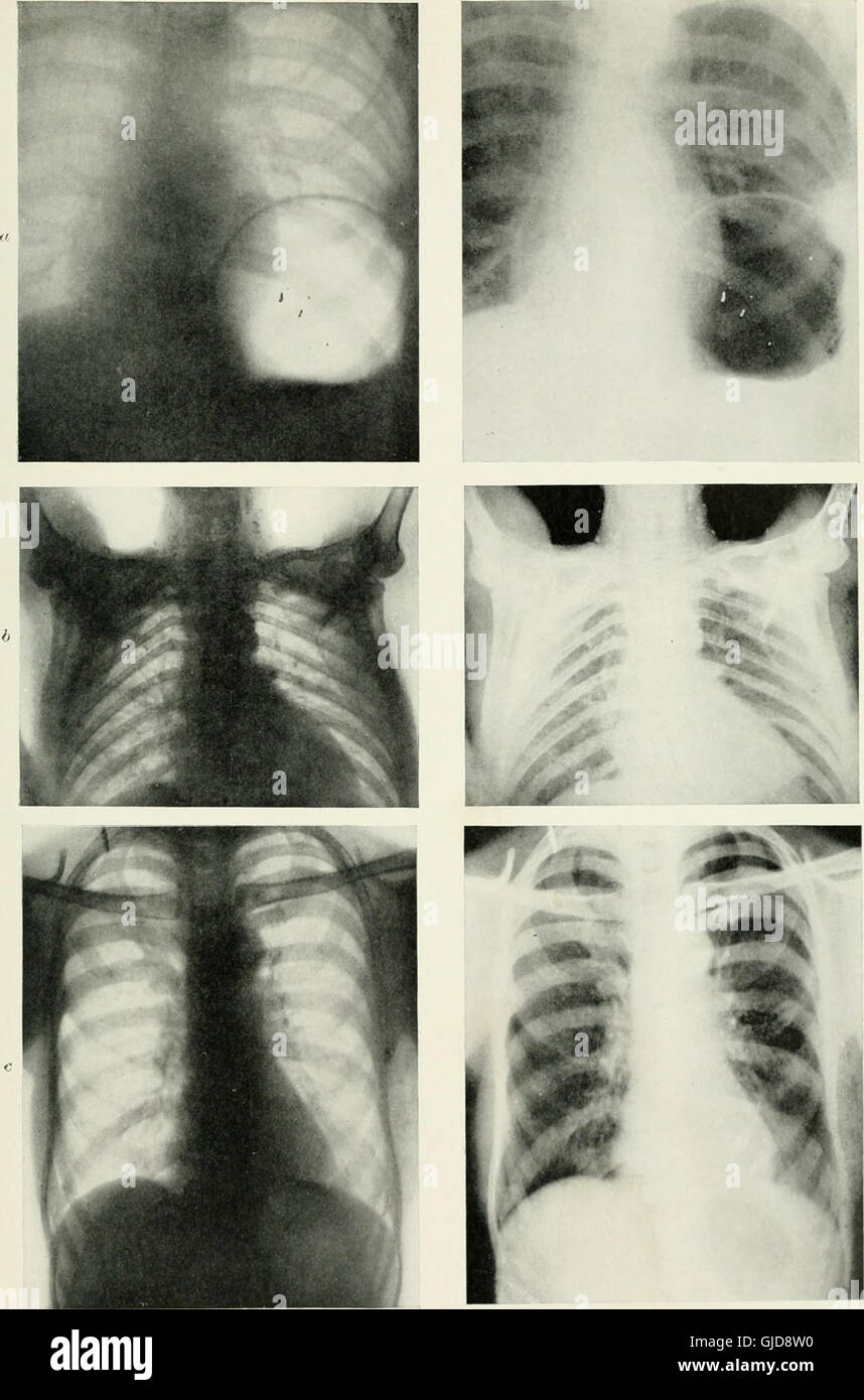 'Radiography, X-ray Therapeutics and Radium Therapy' (1916) explores ...