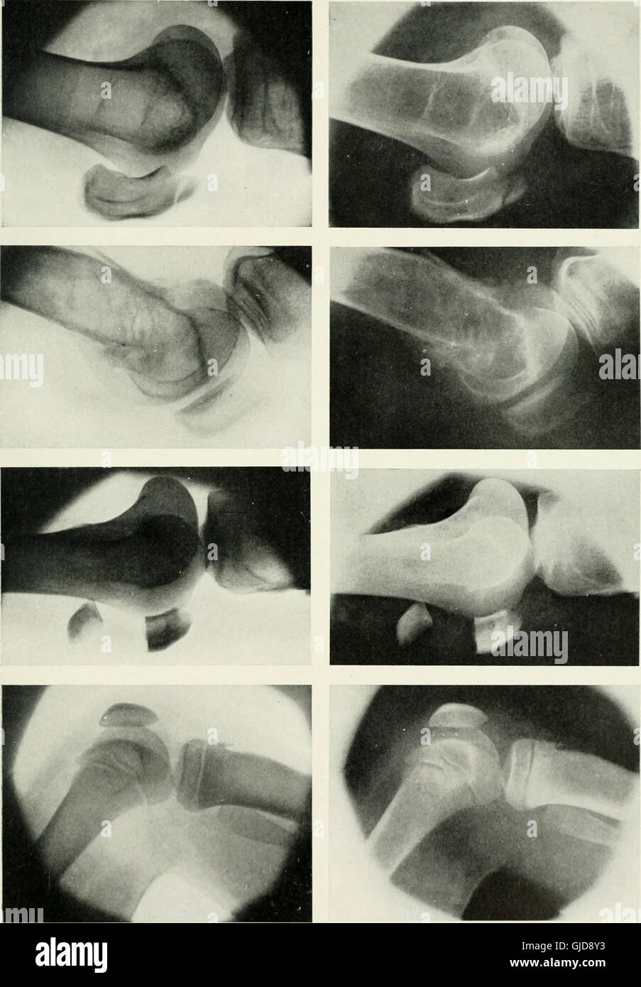 Radium X Ray High Resolution Stock Photography and Images Alamy