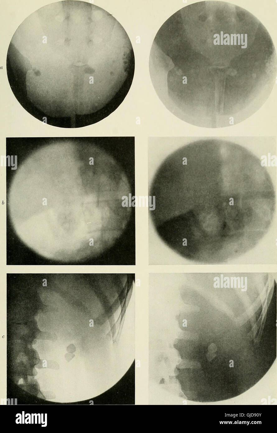 'Radiography, X-ray Therapeutics, and Radium Therapy' (1915) discusses ...