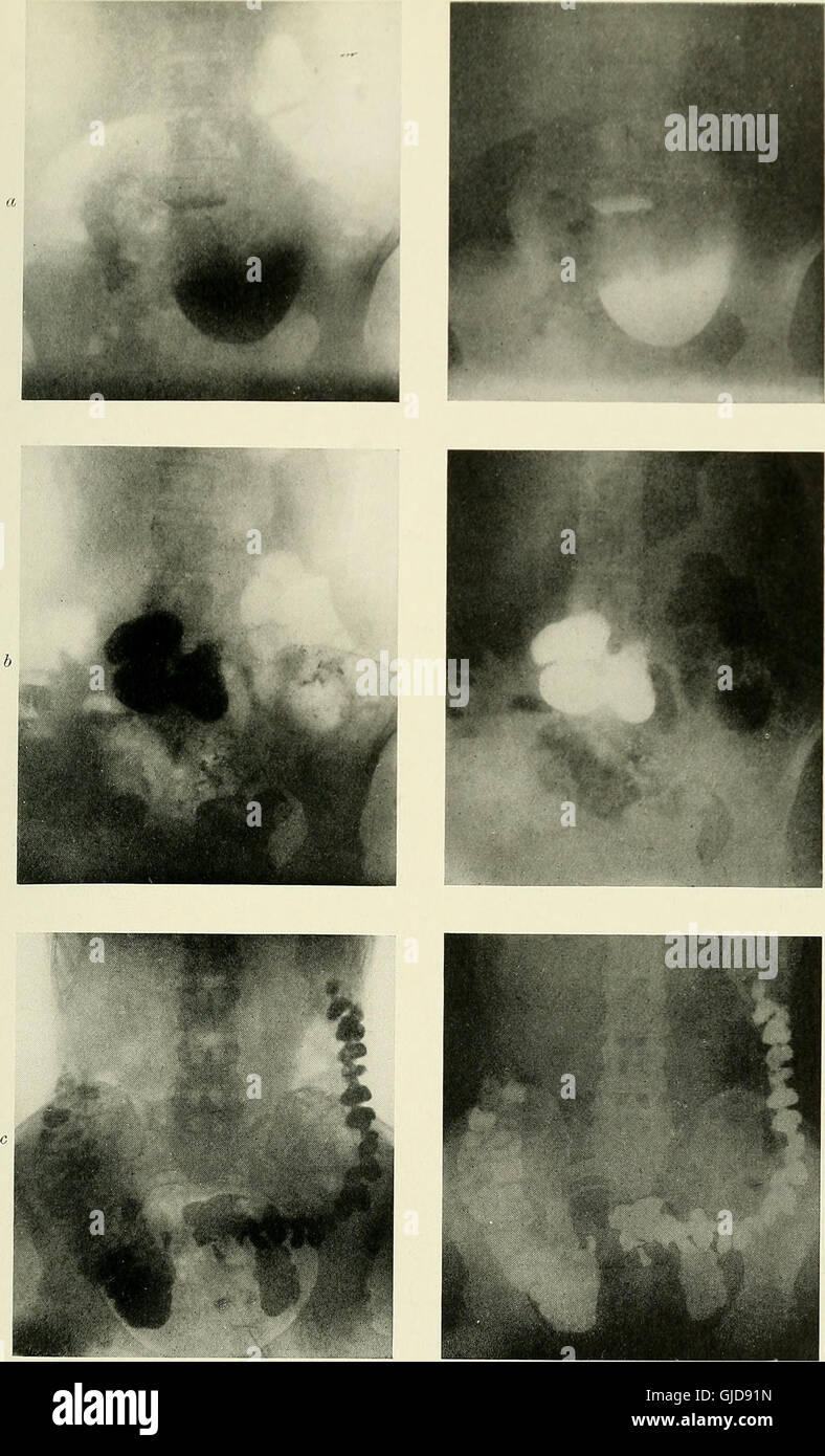 A 1915 publication focusing on the medical applications of radiography ...