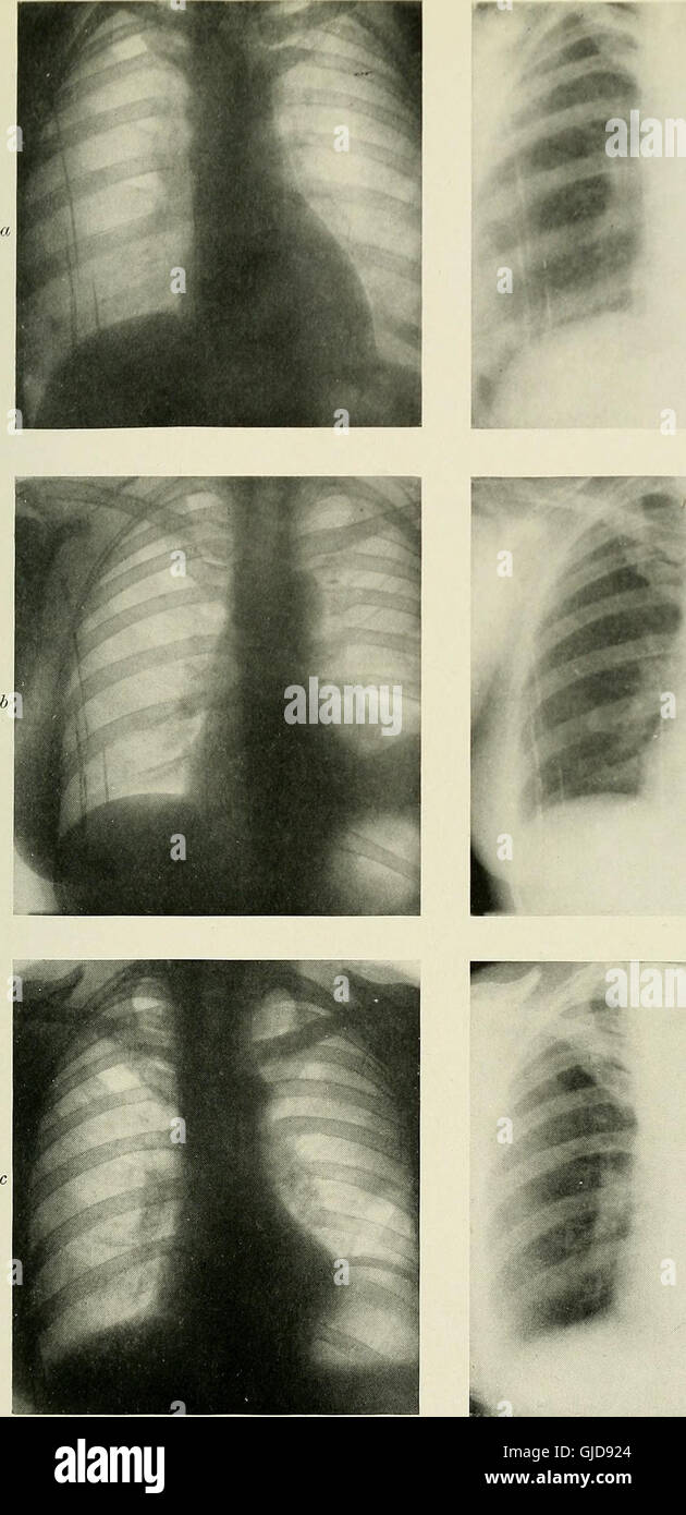 This text discusses the early applications of radiography, X-ray ...