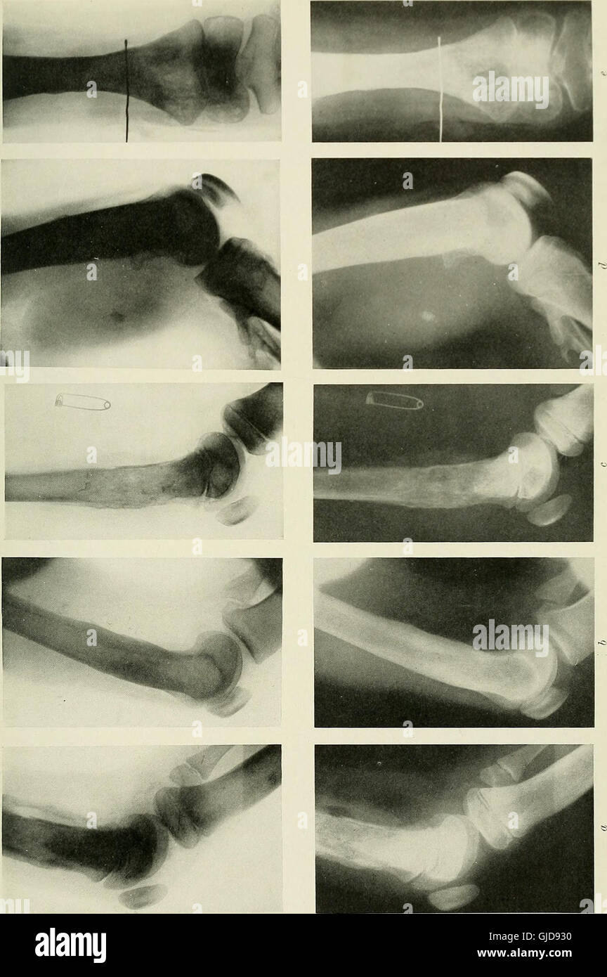 'Radiography, X-ray Therapeutics and Radium Therapy' (1915) discusses ...