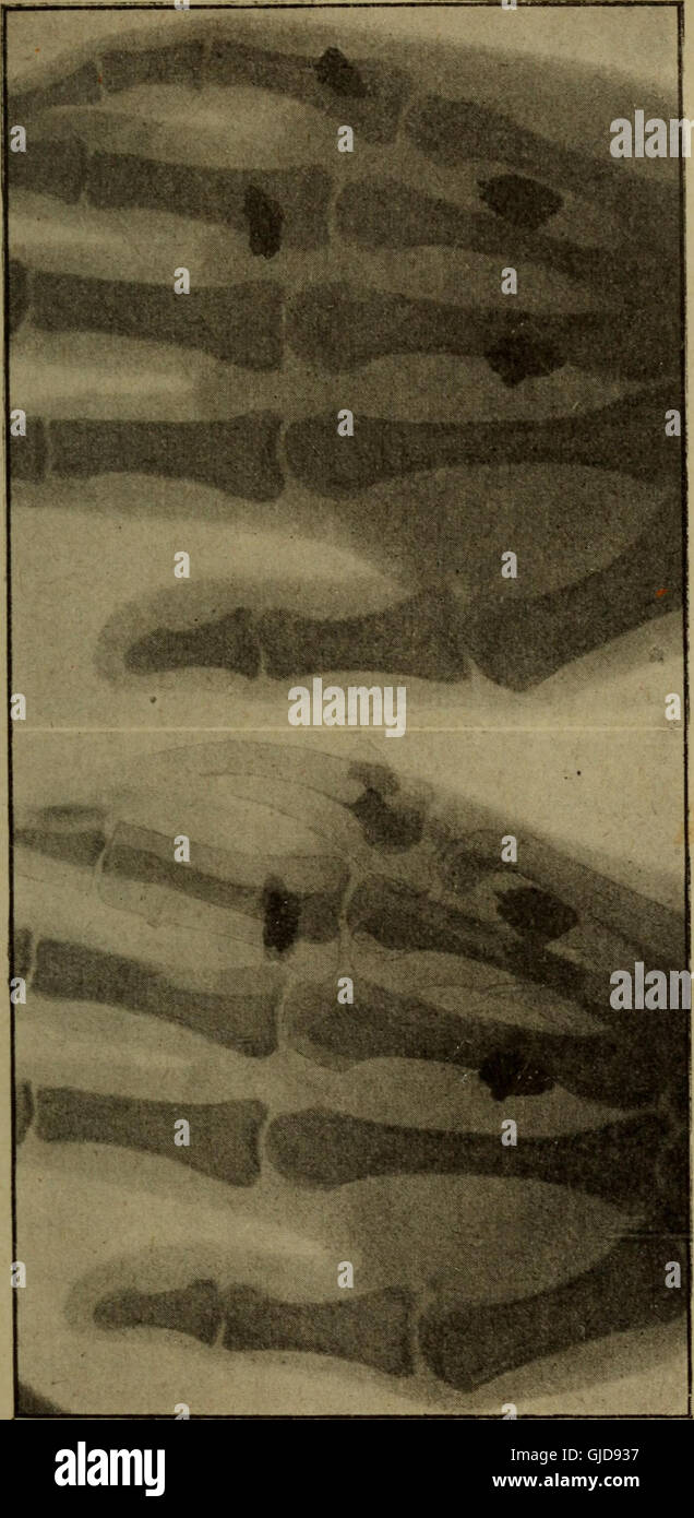 This 1921 work examines the role of radiology in warfare, discussing ...