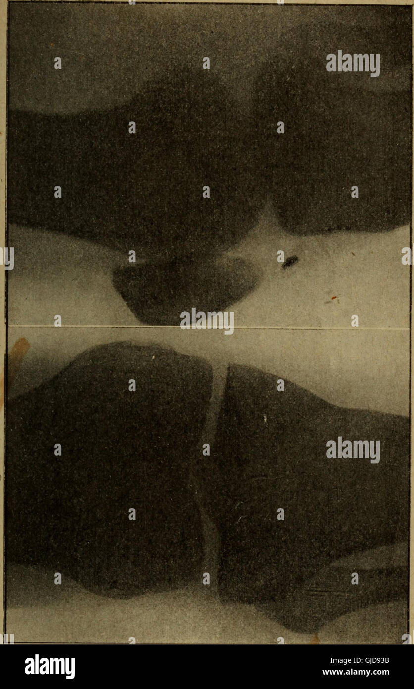 *La Radiologie et la Guerre* (1921) explores the use of radiology in ...