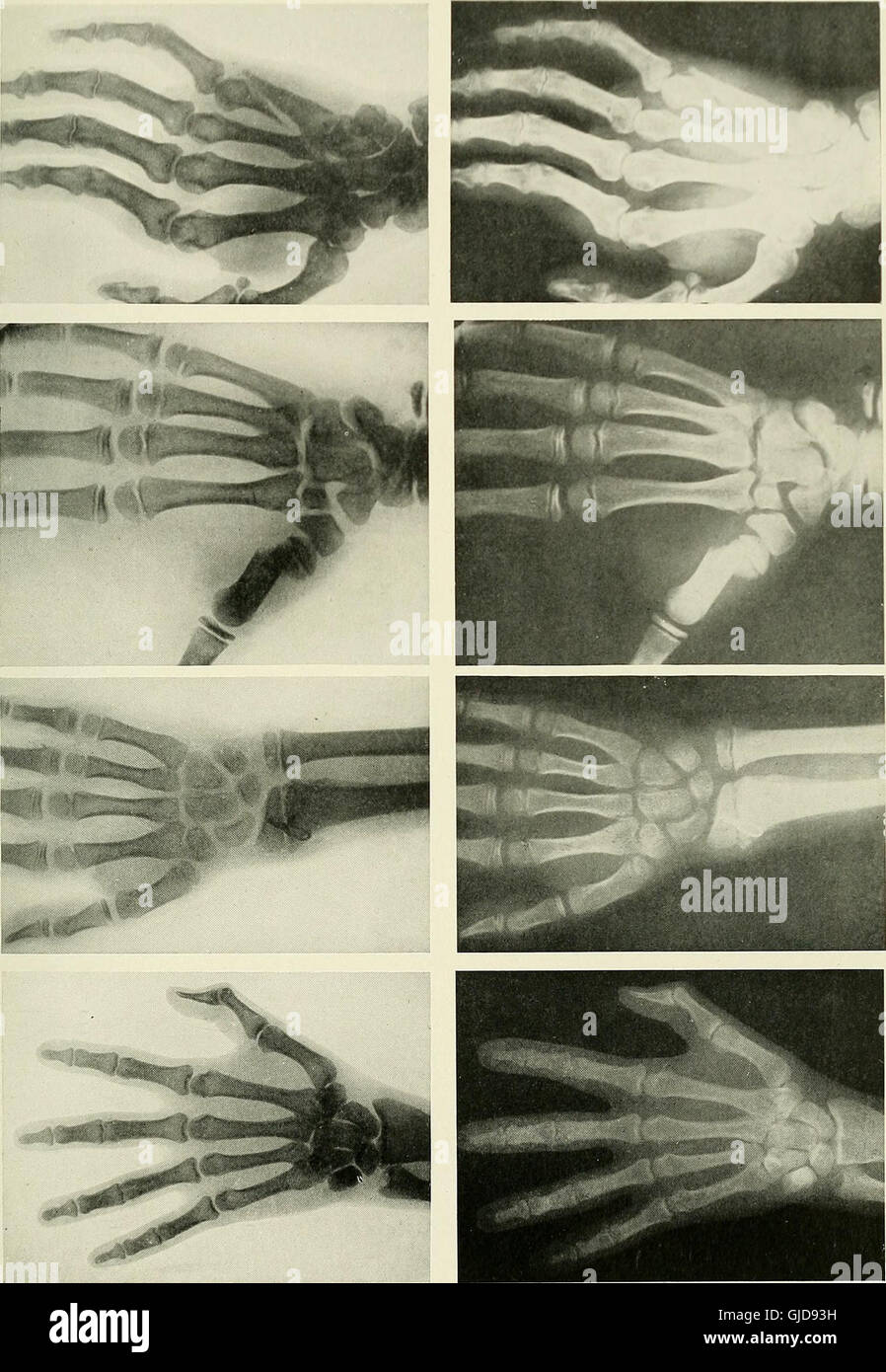A 1915 medical book on radiography, x-ray therapy, and radium ...