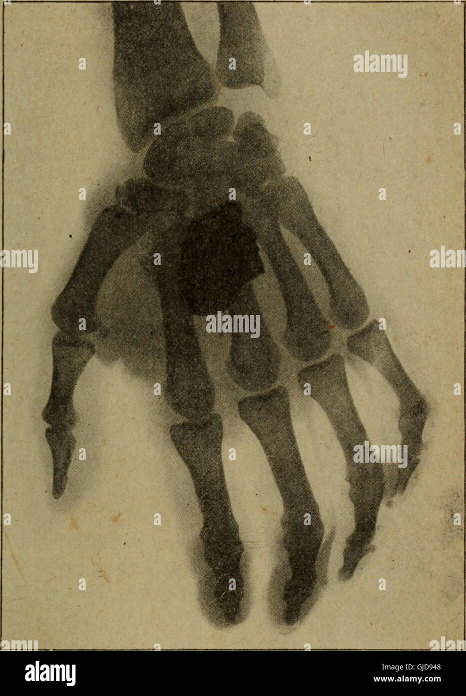 'La radiologie et la guerre' (1921) discusses the role of radiology in ...