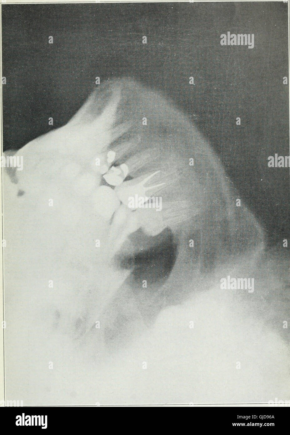 Dental radiology (1913 Stock Photo Alamy