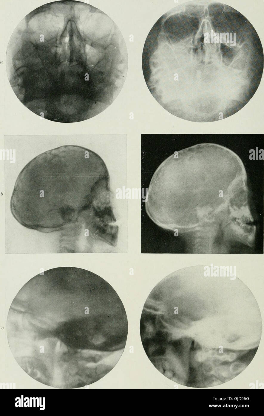 A 1917 text on radiography and radio-therapeutics, detailing the early ...