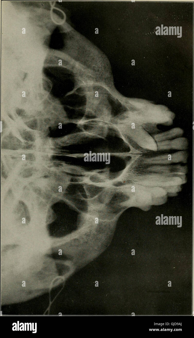 Elementary and dental radiography (1913 Stock Photo Alamy