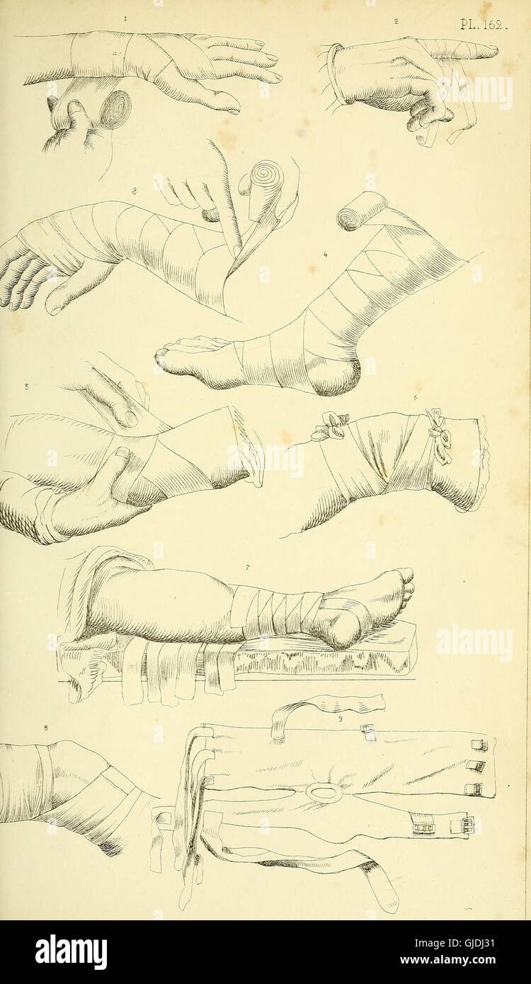 An illustrated surgical manual, providing detailed engravings and ...