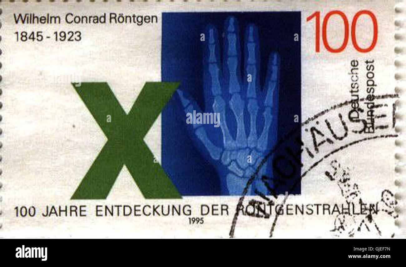 The Stamp Issued To Commemorate The 150th Birthday Of Wilhelm R ntgen the-stamp-issued-to-commemorate-the-150th-birthday-of-wilhelm-r-ntgen