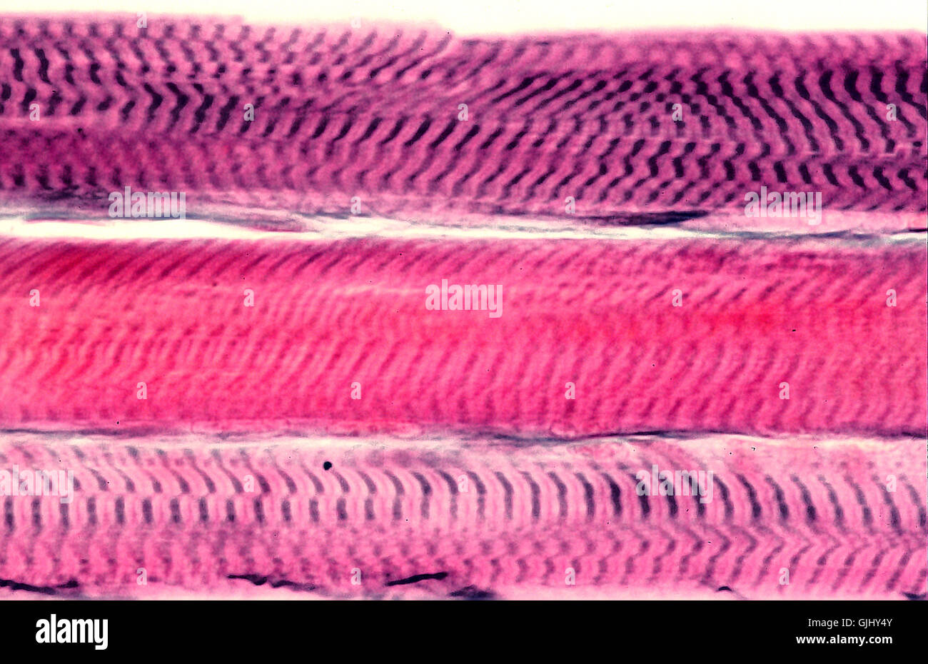 striated muscle Stock Photo