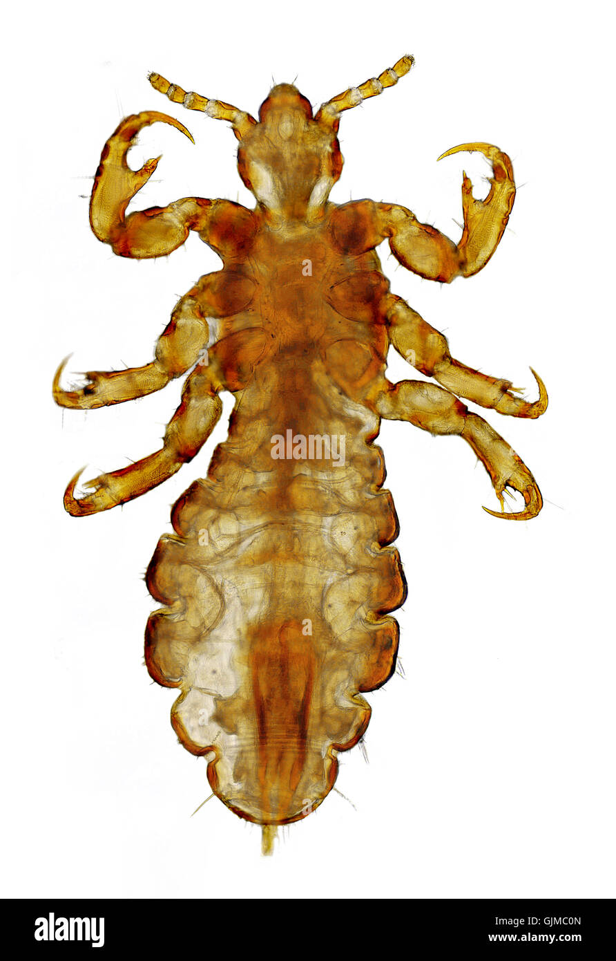 louse cootie hairs Stock Photo
