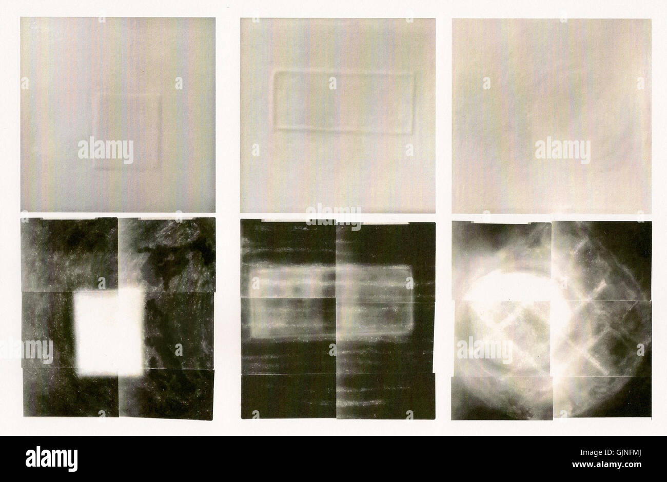 Radiographic image hi-res stock photography and images - Alamy