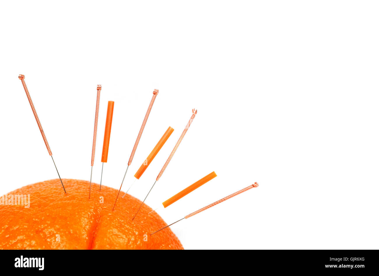 needles acupuncture therapy Stock Photo Alamy