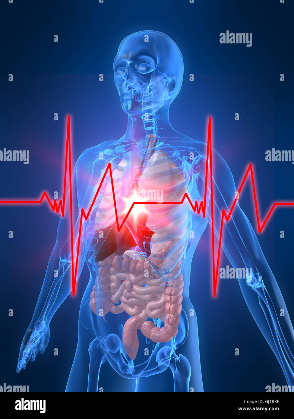 heartbeat artery disease Stock Photo