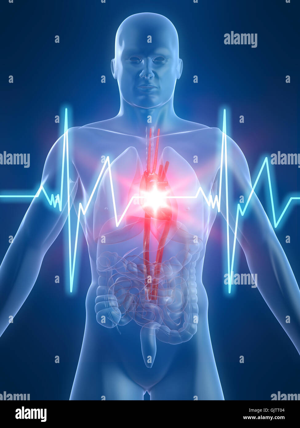 heartbeat artery disease Stock Photo