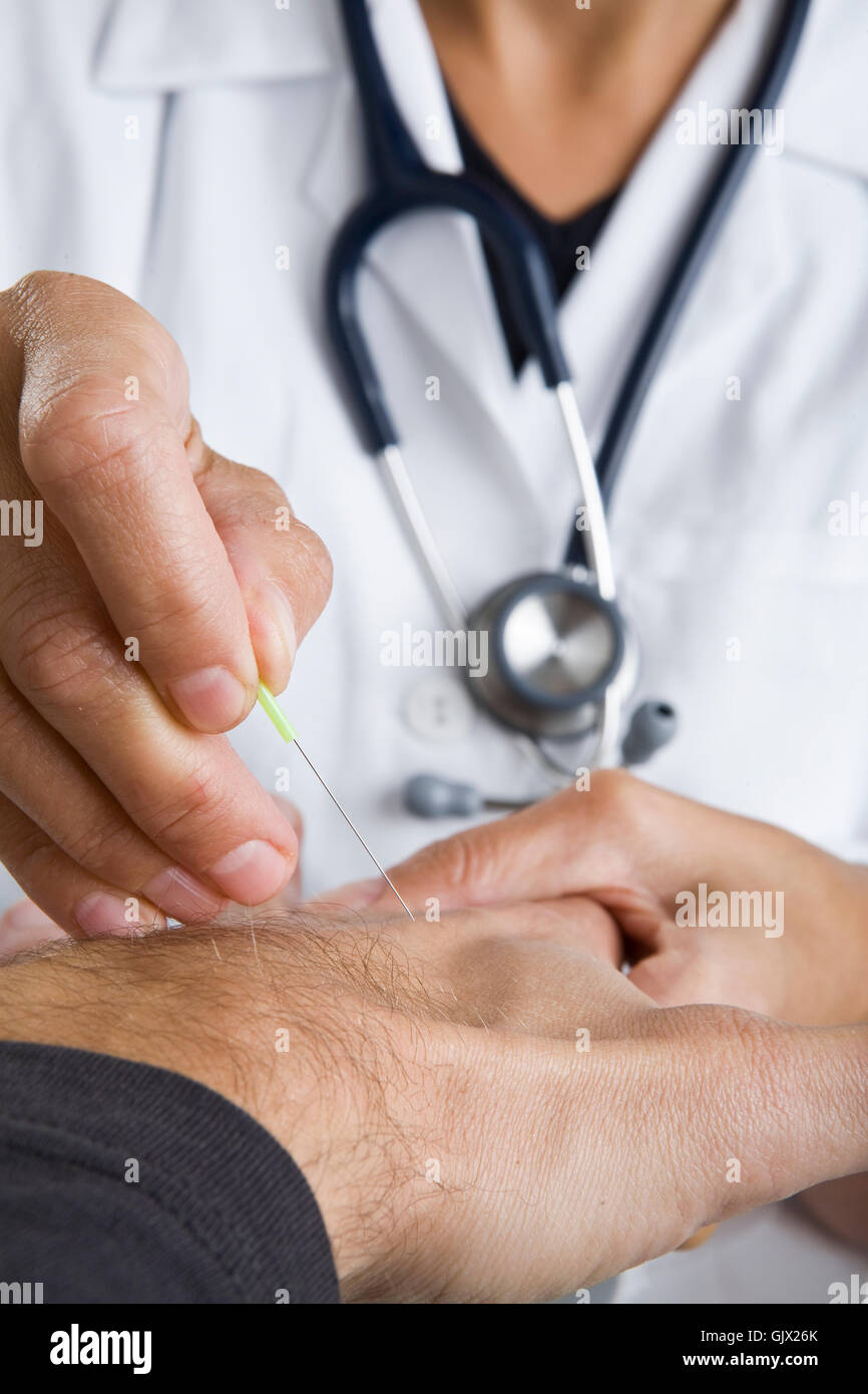 hand needle acupuncture Stock Photo Alamy