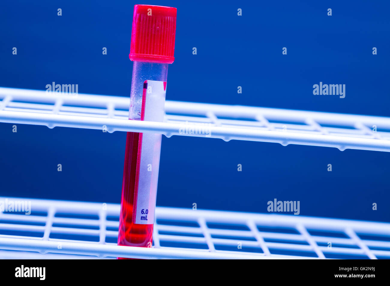 medical vial with blood sample Stock Photo Alamy