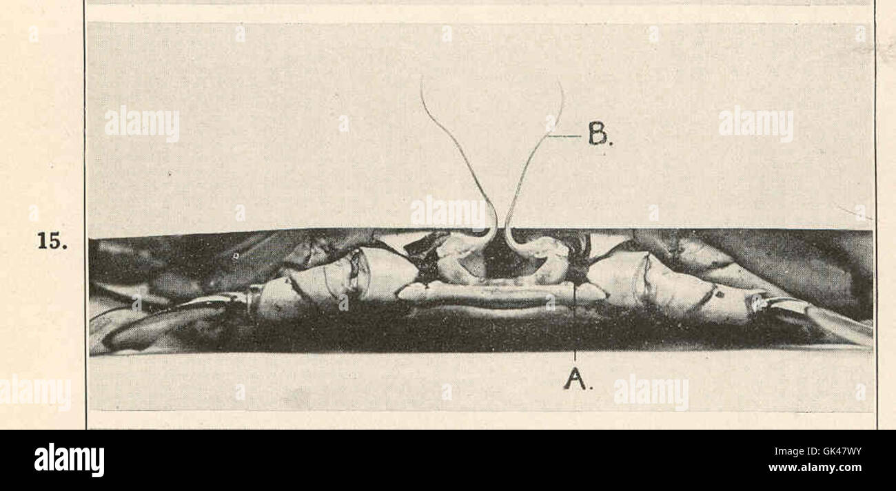 47825 Copulatory organs of male crab Black paper has been placed behind the ducts leading from the reproductive organs A, vas-deferens Stock Photo