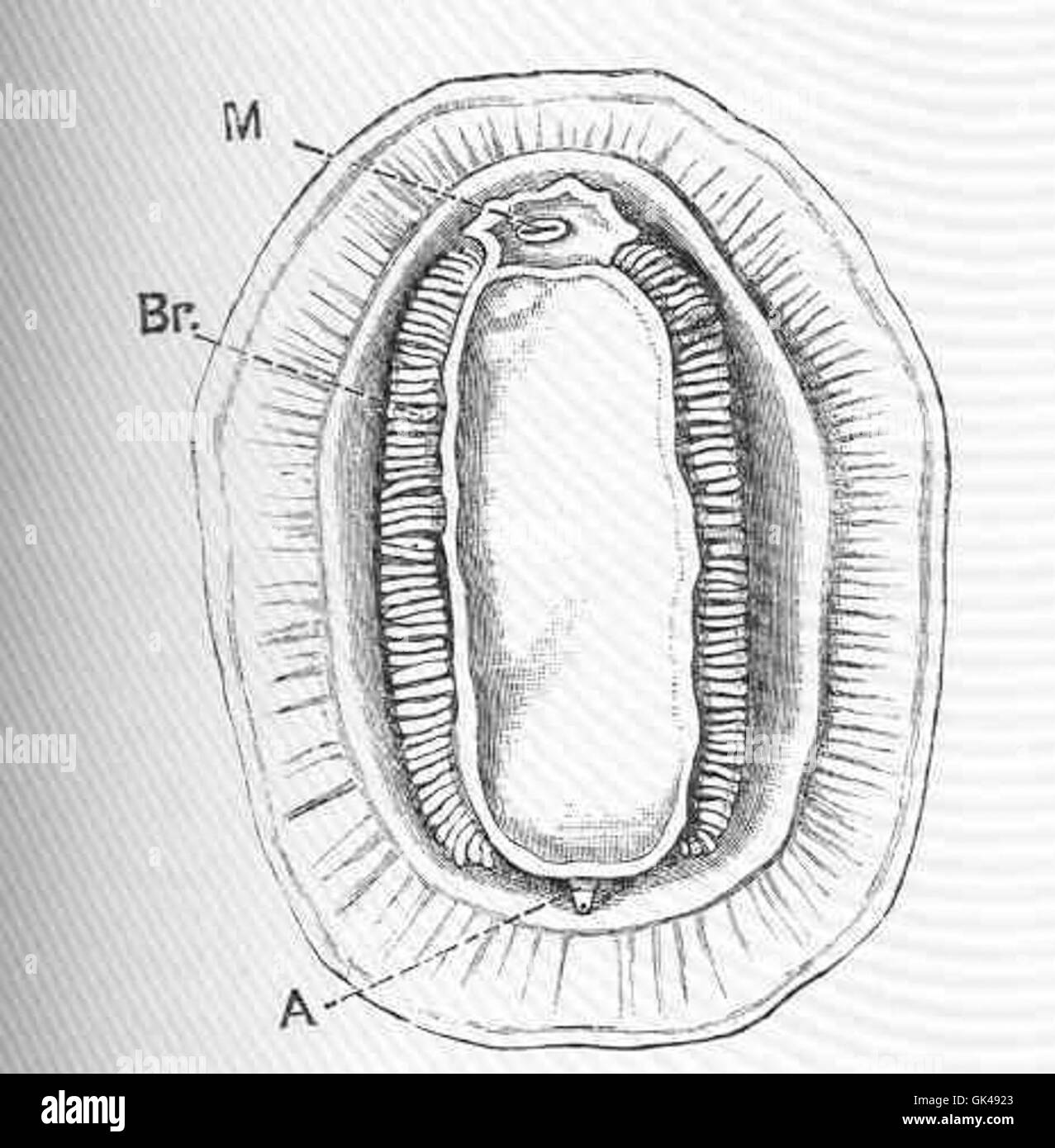 how to remove hair from anus permanently