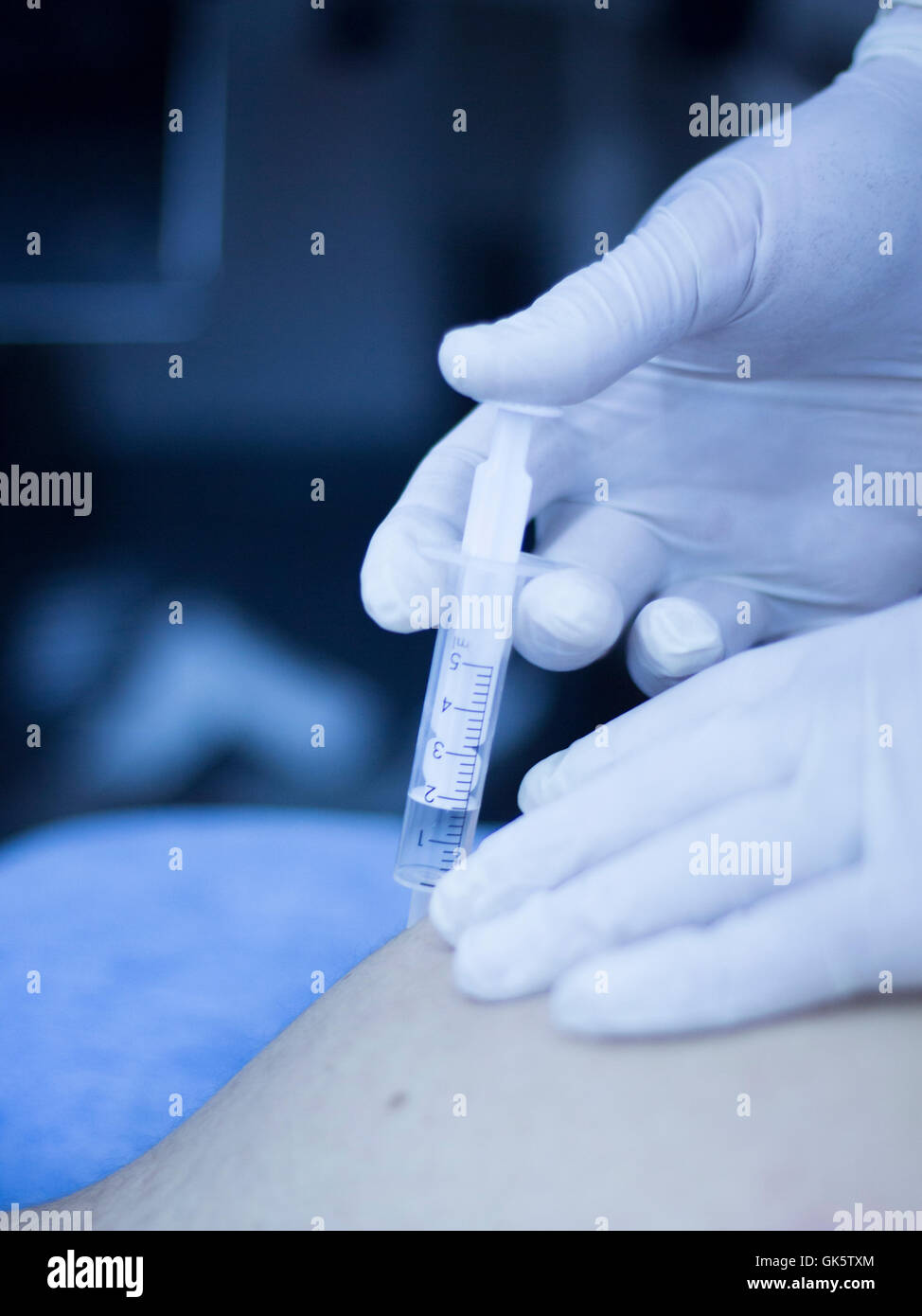 Intratissue Percutaneous Electrolysis EPI with needle injection medical ...