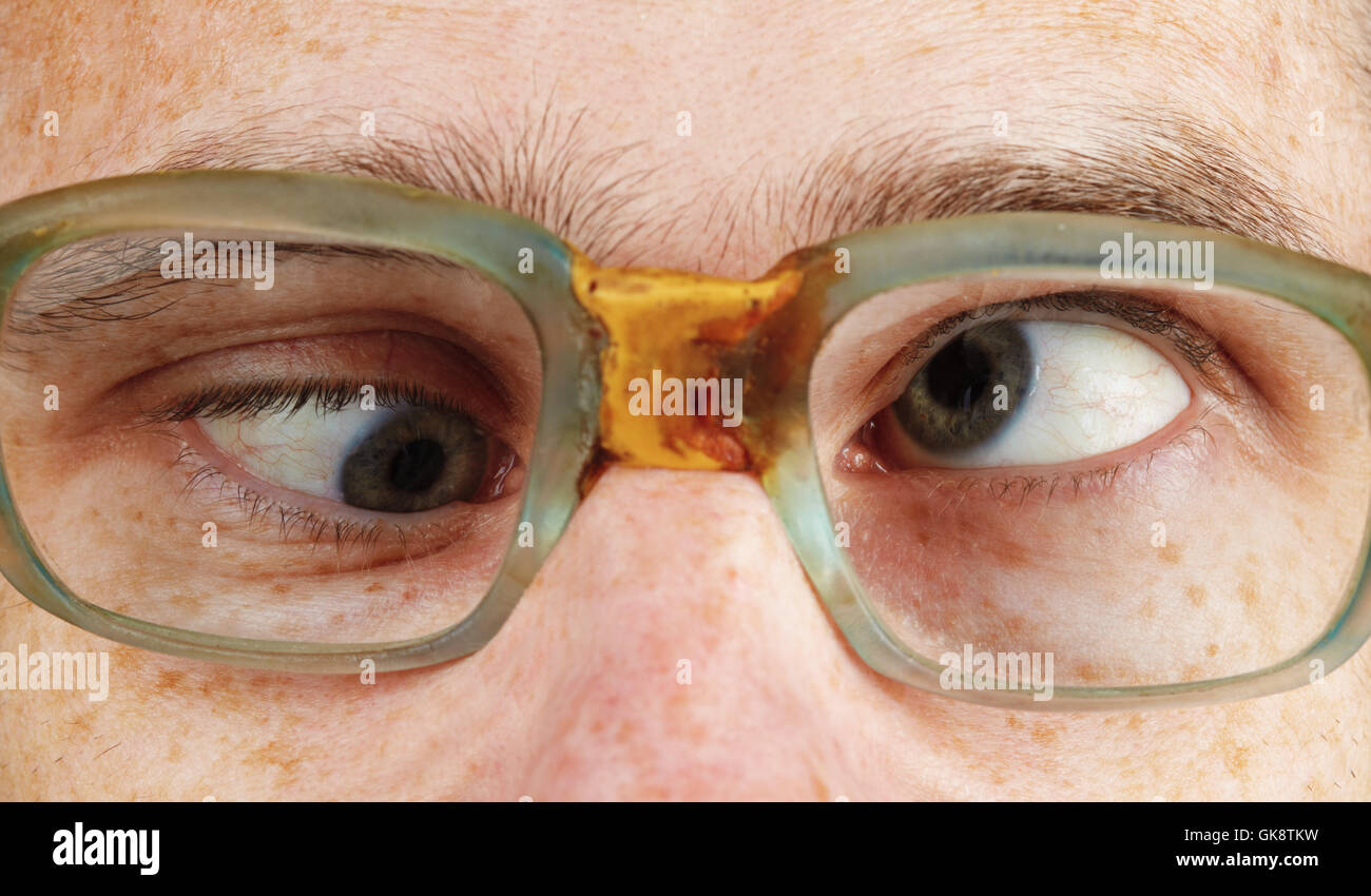 Man eyes crossed funny face hi-res stock photography and images - Alamy
