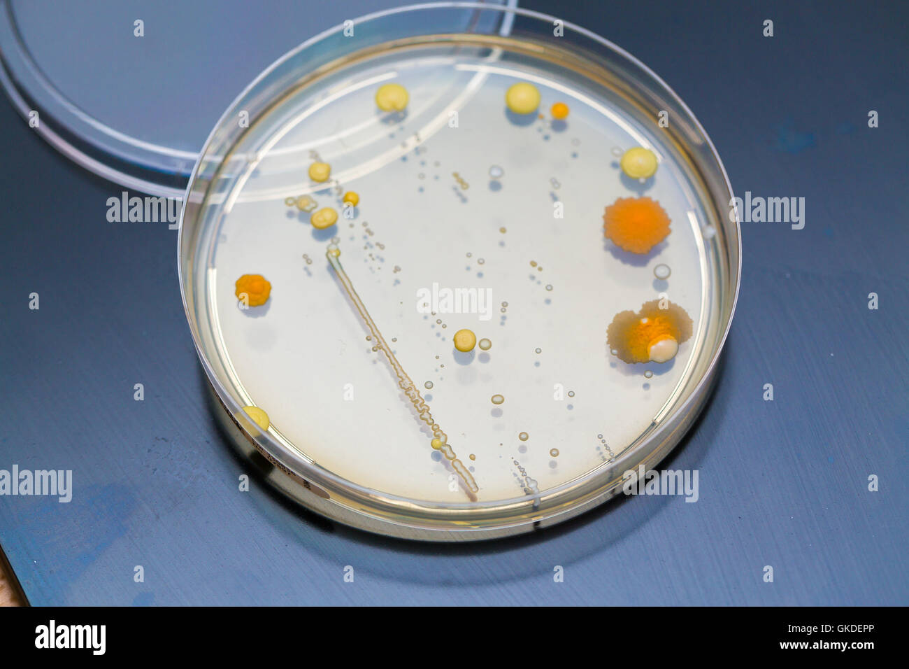 petri dish bacteria growth experiment Stock Photo