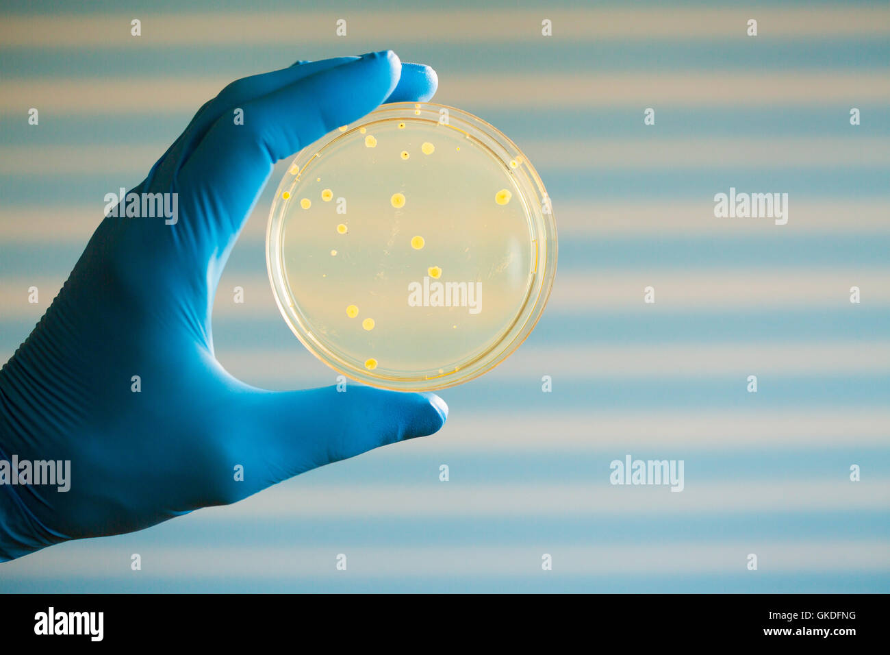 petri dish bacteria growth experiment in hand Stock Photo