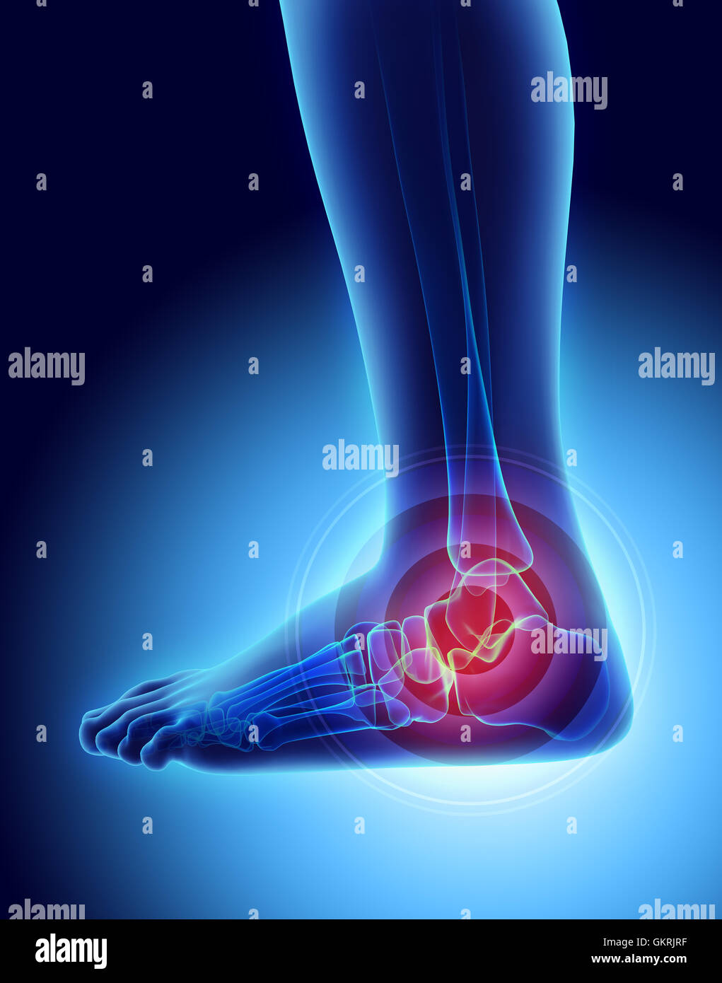 Ankle painful skeleton x ray 3d hi-res stock photography and images - Alamy
