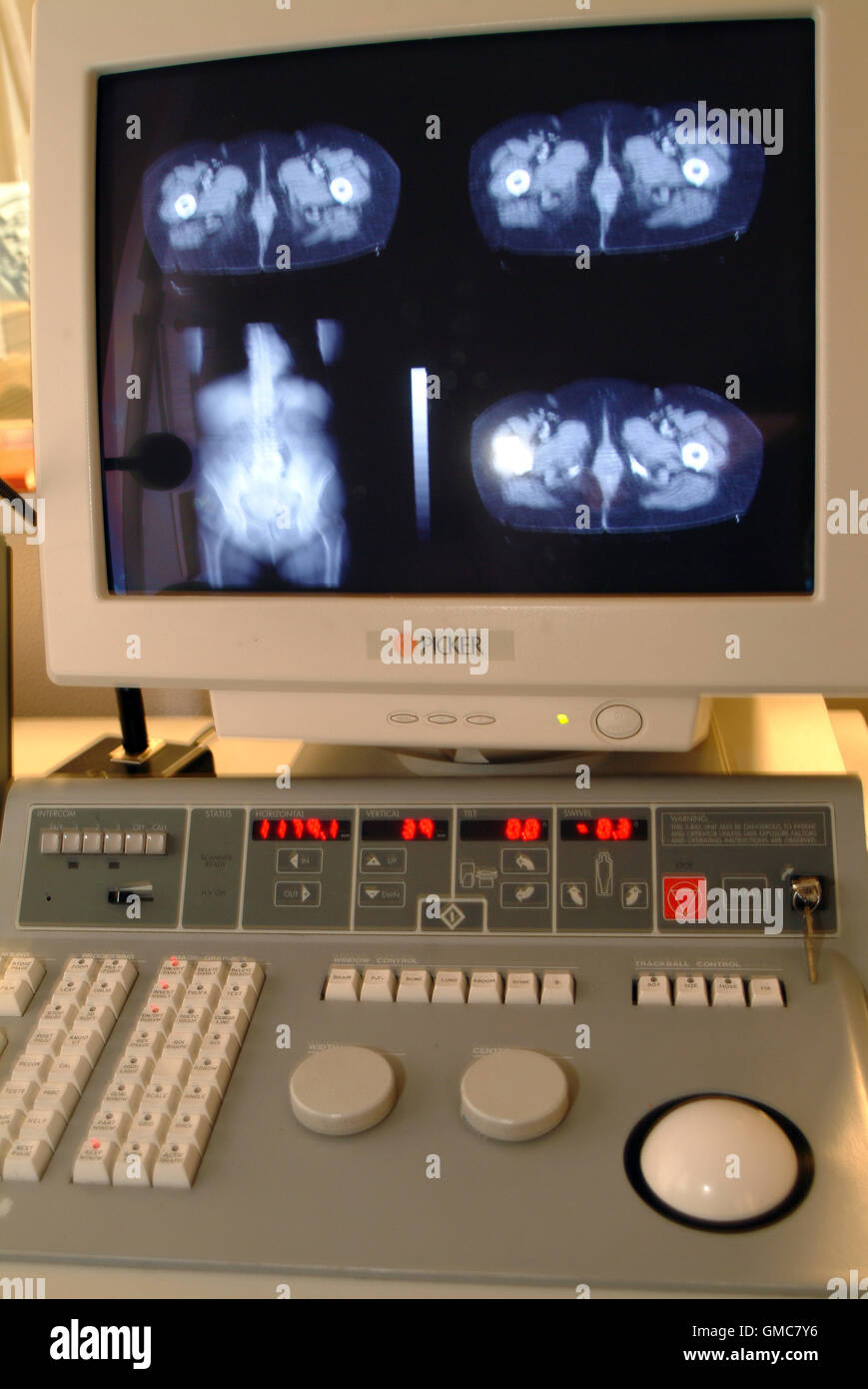MRI examination in hospital Stock Photo Alamy